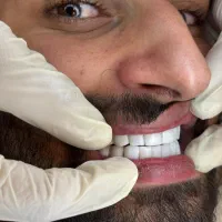 یلدا با تخفیف کامپوزیت|خدمات آرایشگری و زیبایی|ارومیه, |دیوار