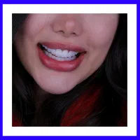 درمان ریشه اندو بریج لمینیت پالیش کامپوزیت عصبکشی