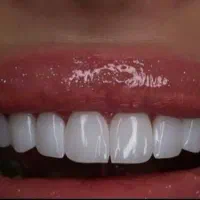 طرف قرارداد با بیمه ها/قیمت استثنایی/باکیفیت|خدمات آرایشگری و زیبایی|شیراز, ملاصدرا|دیوار