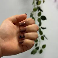 کاشت و ترمیم ناخن هزینه مواد