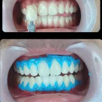 زیبایی|خدمات آرایشگری و زیبایی|تهران, جردن|دیوار