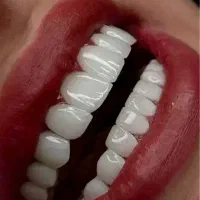 خدمات دندانپزشکی (اقساط)