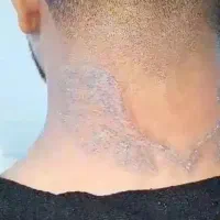 دستگاه کیوسوییچ بهترین برند وارداتی|آرایشی، بهداشتی، درمانی|همدان, |دیوار