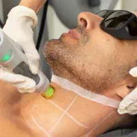 مرکز لیزر موهای زائد-کندلا|خدمات آرایشگری و زیبایی|دوگنبدان, |دیوار