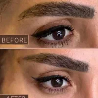 زیبایی لیفت بلفارو فرم بینی بوتاکس نخ ابروزاویه ژل|خدمات آرایشگری و زیبایی|اصفهان, خانه اصفهان|دیوار