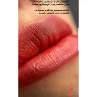 انجام تخصصی شیدلب در صدرا