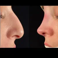 جشنواره لیپو .مامو .بینی بلفارو کل صورت .چک صیادی|خدمات آرایشگری و زیبایی|تهران, دروس|دیوار