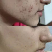 فشیال|خدمات آرایشگری و زیبایی|محمدشهر, محمدشهر|دیوار