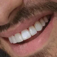 دندانپزشکی اقساطی با تعرفه مناسب|خدمات آرایشگری و زیبایی|هشتگرد, شهرک ولیعصر (مصلی)|دیوار