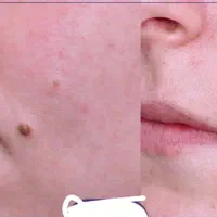 محلول خال. کک مک..    تجهیزات اسب
