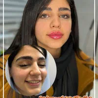 پی ار پی ژل بوتاکس فیلر نخ مزو لیزر ریمو تتو مزوژل|خدمات آرایشگری و زیبایی|مشهد, هفت تیر (حافظ)|دیوار