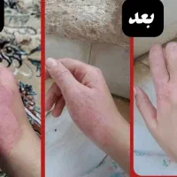 ۱۰۰٪نتیجه|آرایشی، بهداشتی، درمانی|شیراز, احمدآباد|دیوار