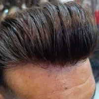 پروتز مو،پروتزموبلک بیس(بدون چسب،جدید)اقساط