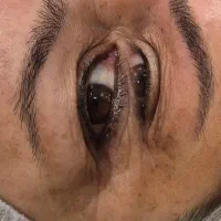 میکرو کرکی و میکرو تلفیقی