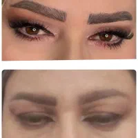 تزریق ژل و بوتاکس وتززیق چربی