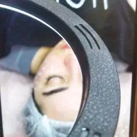 فیشال ،درماپلنینگ،درمان انواع مشکلات پوستی