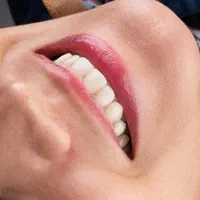 دندانپزشکی، لمینت،ایمپلنت ،دیجیتال،نقدواقساط|خدمات آرایشگری و زیبایی|مشهد, سناباد|دیوار