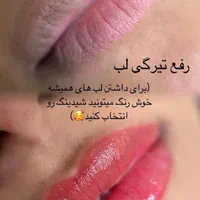 آموزش پک کامل تاتوصورت(فیبروزرژلب و..)دکاپاژوریموو|خدمات آموزشی|گرگان, |دیوار