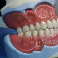 دندان مصنوعی ایتالیایی