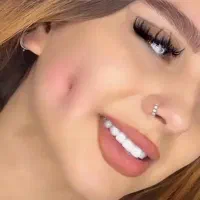 پیرسینگ پلاسما میکرودرمال چال لپ با بخیه