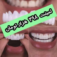 بسار فیکس و سایز همهDMF