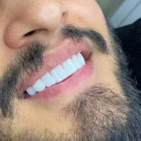 خدمات دندان و دندانسازی (اقساطی -بادکی و کوهنورد )