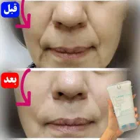 کرم سفید کننده پوست|آرایشی، بهداشتی، درمانی|اسلامآباد غرب, |دیوار