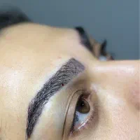 کاشت ابرو شاهین دژ
