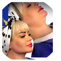 تخلیه غبغب .بکینی .باسن .صورت. تخفیفات ویژه دوروز