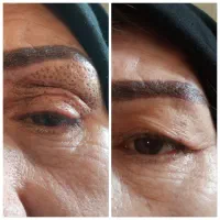 پلکسر و پلاسما آف ویژه