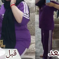 لاغری بدون ورزش و رژیم سخت|آرایشی، بهداشتی، درمانی|زاهدان, |دیوار