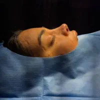 رینوپلاستی ۲۵میلیون|خدمات آرایشگری و زیبایی|قرچک, زیبا شهر|دیوار