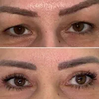 کاشت ابروعمل پلک لیفت کانتور بوکال لیپو غبغب، ژل