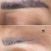 ریموو تک‌جلسه ای با رجووی اصل ومیکروبلیدینگ شیدینگ|خدمات آرایشگری و زیبایی|رشت, لاکانی|دیوار