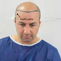 جشنواره‌پایزه‌کاشت‌موریش‌وابروشیرازی‌دراردبیل‌قساط|خدمات آرایشگری و زیبایی|اردبیل, |دیوار