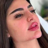 تزریق ژل و بوتاکس بدون درد و کبودی|خدمات آرایشگری و زیبایی|بروجن, |دیوار