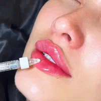 ژل و بوتاکس