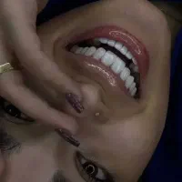 جشنواره فوق العاده کامپوزیت دندان فکی ۳/۸۶۰