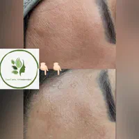 فیشال فقط ۳۵۰ (پاکسازی پوست) حرفه ای به مدت محدود|خدمات آرایشگری و زیبایی|صدرا-فارس, فاز ۱|دیوار