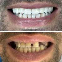 دندانپزشکی دکتر زینب حیدری پور|خدمات آرایشگری و زیبایی|کرج, مصباح|دیوار