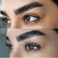 لیفت ابرو دهلران