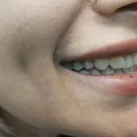 ساخت انواع دندان مصنوعی + لابراتوار دندانساری|خدمات آرایشگری و زیبایی|تهران, یافت آباد جنوبی|دیوار