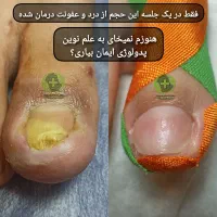درمان بیماری های ناخن بدون جراحی درکلینیک|خدمات آرایشگری و زیبایی|ورامین, خیر آباد|دیوار