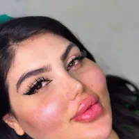 جشنواره تزریق ژل و بوتاکس/آموزش تخصصی/فشیال تخصصی