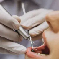 نوبت فوری دندان پزشکی کلینیک تامین اجتماعی سنندج