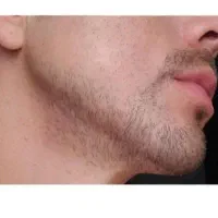کاشت ممنوع