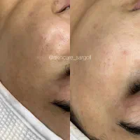 پاکسازی و فیشال|خدمات آرایشگری و زیبایی|شیراز, معالی‌آباد|دیوار