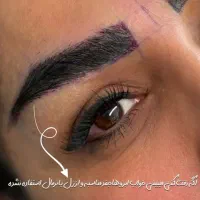 ظرفیت ویژه کاشت ابرو فقط برای ۳ نفر