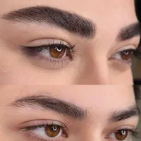 فیبروز میکروبلیدینگ میکرو کرکی مویی شیدینگ خطچشم
