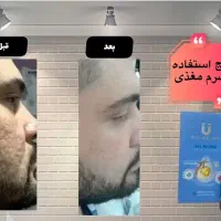 اکسیرجوانی|آرایشی، بهداشتی، درمانی|تالش, هشتپر|دیوار